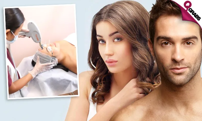 Laser Resurfacing & Laser Peel Sessions!
